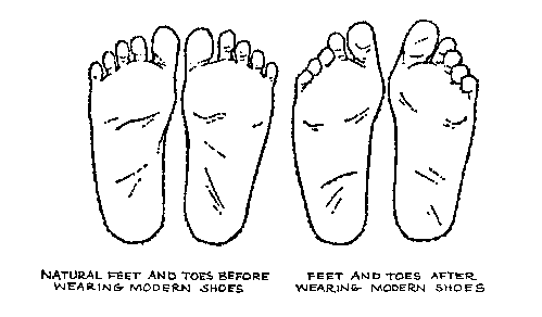 Flat Feet